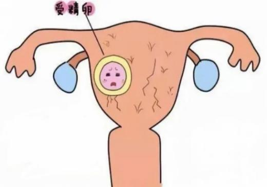 怀孕冷知识/生化妊娠(图2)