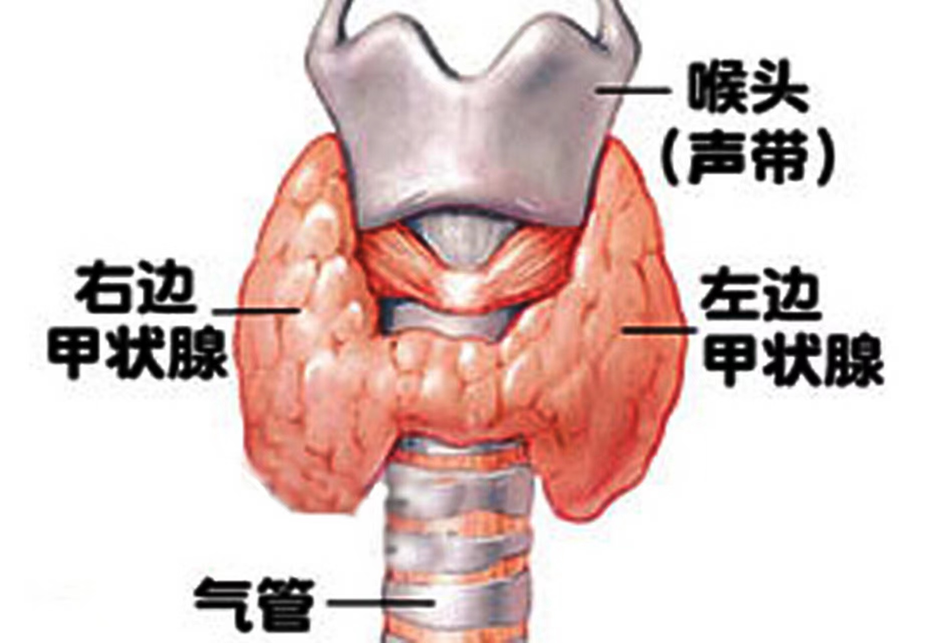 1-230G01Z4515Y.jpg 1-230G01Z4515Y.jpg