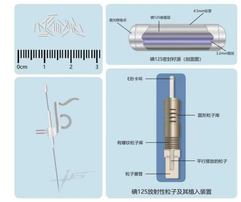 放射性魔法125I:从内到外的微妙舞蹈(图2)