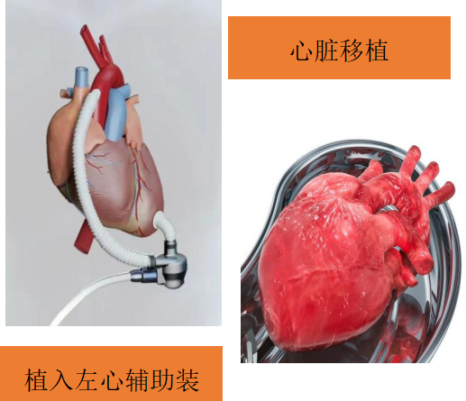 关注心衰,守护心脏(图9)