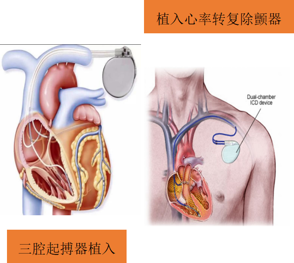 关注心衰,守护心脏(图8)