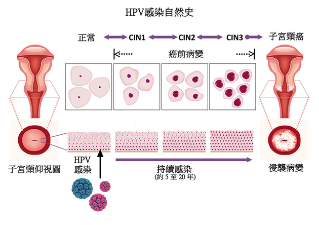 守“宫”有道 | HPV疫苗的自述(图3)
