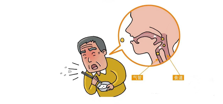 喝水呛咳怎么办?带你做口颜面部肌肉操(图2)