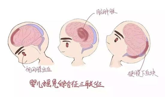 爱的摇篮不摇晃,科学育儿有保障(图4)