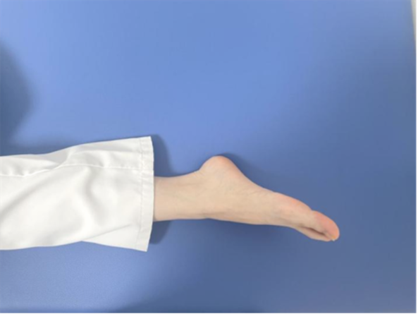 预防深静脉血栓，共同守护血管健康！(图11)